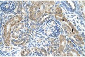 Immunohistochemical staining (Formalin-fixed paraffin-embedded sections) of human kidney with CRELD1 polyclonal antibody  at 4-8 ug/mL working concentration. (CRELD1 anticorps  (C-Term))
