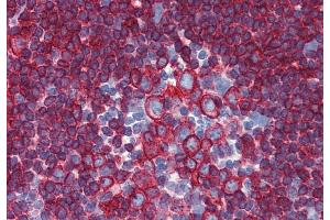 Immunohistochemistry staining of human small intestine (paraffin-embedded sections) with anti-HLA-DR+DP (HL-40). (HLA-DP/DR anticorps)