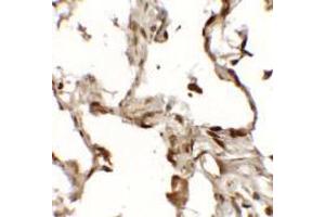 Immunohistochemistry of TFEB (NT) in human lung tissue with TFEB (NT) antibody at 2. (TFEB anticorps  (N-Term))