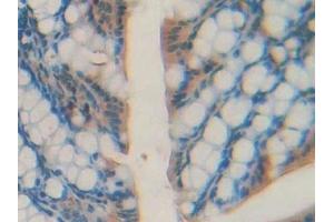 Detection of AGRP in Mouse Intestine Tissue using Polyclonal Antibody to Agouti Related Protein (AGRP)