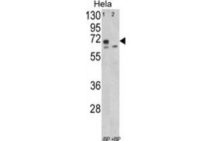 Western Blotting (WB) image for anti-Leiomodin 1 (LMOD1) antibody (ABIN3003829) (Leiomodin 1 anticorps)