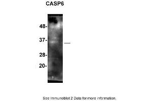 Sample: SH-SY5Y cells  2. (Caspase 6 anticorps  (Middle Region))