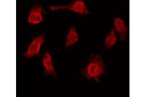 ABIN6272449 staining 293 by IF/ICC. (TRF1 anticorps  (Internal Region))