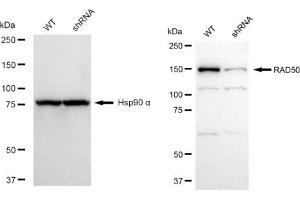 Western blotting analysis using RAD50 antibody (ABIN7800119). (Recombinant RAD50 anticorps)