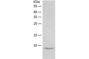 Western Blotting (WB) image for Amphiregulin (AREG) (AA 101-198) protein (His tag) (ABIN7121819) (Amphiregulin Protein (AREG) (AA 101-198) (His tag))