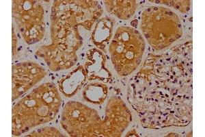 IHC image of ABIN7150750 diluted at 1:100 and staining in paraffin-embedded human kidney tissue performed on a Leica BondTM system.