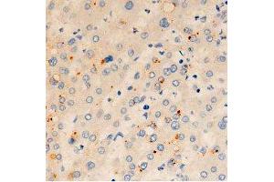 ABIN6278065 at 1/100 staining human liver tissue sections by IHC-P. (ORAI1 anticorps  (C-Term))