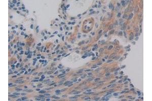 Detection of PDHX in Mouse Ovary Tissue using Polyclonal Antibody to Pyruvate Dehydrogenase Complex Component X (PDHX) (PDHX anticorps  (AA 222-471))