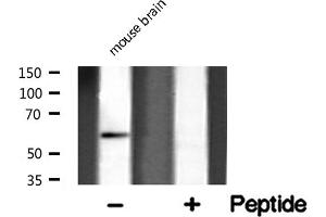 Western blot analysis of GLU2B expression in mouse brain lysate (PRKCSH anticorps  (Internal Region))