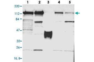 Western blot analysis of Lane 1: RT-4, Lane 2: U-251 MG, Lane 3: Human Plasma, Lane 4: Liver, Lane 5: Tonsil with PPFIBP1 polyclonal antibody  at 1:250-1:500 dilution. (PPFIBP1 anticorps)
