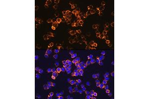Immunofluorescence analysis of Jurkat cells using IL10 Rabbit mAb (ABIN7267981) at dilution of 1:100 (40x lens). (IL-10 anticorps)