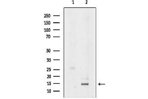 anti-Chemokine (C-C Motif) Ligand 24 (CCL24) (C-Term) antibody