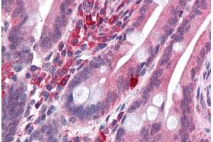 Human Small Intestine: Formalin-Fixed, Paraffin-Embedded (FFPE) (LYRM2 anticorps  (C-Term))