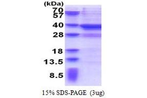 SDS-PAGE (SDS) image for metallophosphoesterase Domain Containing 2 (MPPED2) (AA 1-294) protein (His tag) (ABIN6387324)