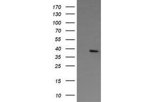 Image no. 1 for anti-Nudix (Nucleoside Diphosphate Linked Moiety X)-Type Motif 9 (NUDT9) antibody (ABIN1499875) (NUDT9 anticorps)