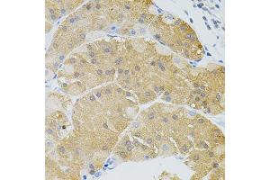 Immunohistochemistry of paraffin-embedded human stomach using SYK Antibody (ABIN5971150) at dilution of 1/100 (40x lens). (SYK anticorps)