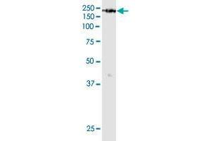 KDM6A monoclonal antibody (M05), clone 4E7. (KDM6A anticorps  (AA 641-740))