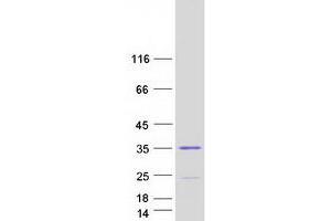 Validation with Western Blot (Spindlin 2B Protein (SPIN2B) (Transcript Variant 3) (Myc-DYKDDDDK Tag))