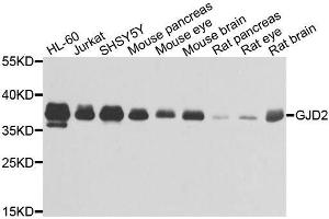Western blot analysis of extracts of various cell lines, using GJD2 antibody. (GJD2 anticorps  (AA 99-197))