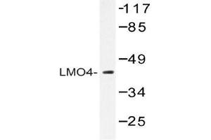 Western blot (WB) analysis of LMO4 antibody in extracts from 293 cells. (LMO4 anticorps)