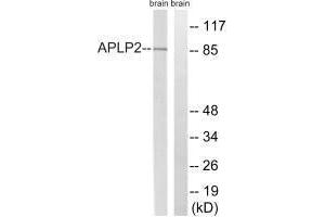Western blot analysis of extracts from rat brain cells, using APLP2 (Ab-755) antibody.