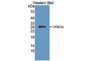 Figure. (CIB1 anticorps  (AA 2-191))