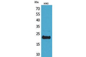 Western Blotting (WB) image for anti-Leukemia Inhibitory Factor (LIF) (C-Term) antibody (ABIN3178138) (LIF anticorps  (C-Term))