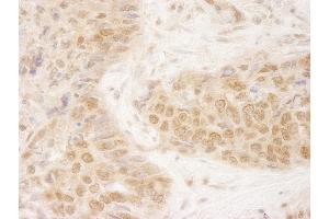 Immunohistochemistry (IHC) image for anti-Kinesin Family Member 2C (KIF2C) (AA 50-100) antibody (ABIN7448646) (KIF2C anticorps  (AA 50-100))