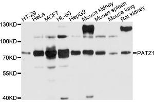 Western blot analysis of extracts of various cell lines, using PATZ1 antibody (ABIN4904681) at 1:1000 dilution. (PATZ1 anticorps)