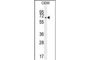 Western blot analysis in CEM cell line lysates (35ug/lane). (COX10 anticorps  (C-Term))