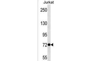 ANKRD56 Antibody (Center) (ABIN1538405 and ABIN2850334) western blot analysis in Jurkat cell line lysates (35 μg/lane). (SOWAHB anticorps  (AA 412-438))