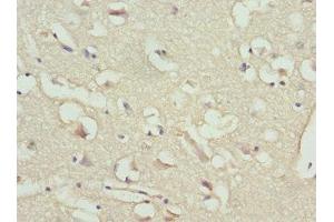 IHC analysis of paraffin-embedded human brain tissue, using NT-proBNP antibody (1/100 dilution). (NT-ProBNP anticorps  (AA 27-102))