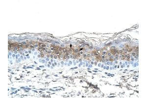 Fibrinogen Alpha antibody was used for immunohistochemistry at a concentration of 4-8 ug/ml to stain Squamous epithelial cells (arrows) in Human Skin. (FGA anticorps  (N-Term))