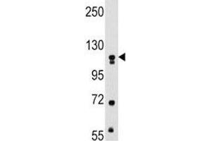 Western blot analysis of MUSK antibody and mouse kidney tissue lysate.
