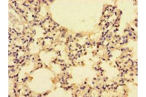 Immunohistochemistry of paraffin-embedded human lung tissue using ABIN7146002 at dilution of 1:100 (CCL4 anticorps  (AA 24-84))