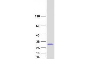 Validation with Western Blot