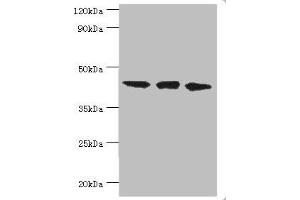 Western blot All lanes: TAR DNA-binding protein 43 antibody at 8 μg/mL Lane 1: Hela whole cell lysate Lane 2: Mouse spleen tissue Lane: K562 whole cell lysate Secondary Goat polyclonal to rabbit IgG at 1/10000 dilution Predicted band size: 45, 32 kDa Observed band size: 45 kDa (TARDBP anticorps  (AA 1-260))