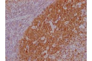 IHC image of ABIN7180562 diluted at 1:100 and staining in paraffin-embedded human lymph node tissue performed on a Leica BondTM system. (POU2AF1 anticorps)