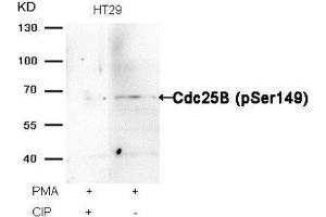 Western blot analysis of extracts from HT29 cells, treated with PMA or calf intestinal phosphatase (CIP), using Cdc25B (Phospho-Ser149) Antibody. (CDC25B anticorps  (pSer149))