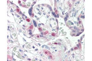 Anti-CDK2 antibody IHC of human placenta. (CDK2 anticorps)