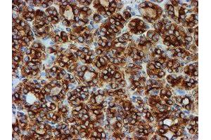 Image no. 9 for anti-Tubulin beta 4a (TUBB4A) antibody (ABIN1501579)