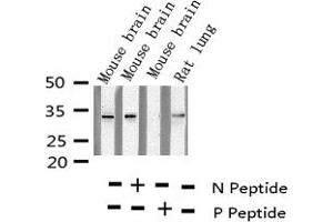 Western blot analysis of Phospho-S6 Ribosomal Protein (Ser235) expression in various lysates