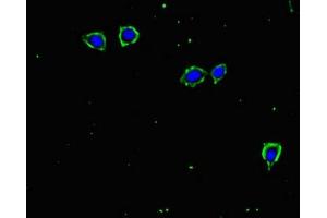 Immunofluorescent analysis of MCF-7 cells using ABIN7171961 at dilution of 1:100 and Alexa Fluor 488-congugated AffiniPure Goat Anti-Rabbit IgG(H+L) (TGFBR2 anticorps  (AA 25-159))