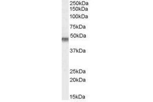 Image no. 1 for anti-Potassium Inwardly-Rectifying Channel, Subfamily J, Member 11 (KCNJ11) (Internal Region), (N-Term) antibody (ABIN374886) (KCNJ11 anticorps  (Internal Region, N-Term))