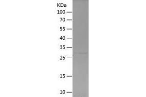 Western Blotting (WB) image for Keratin 6B (KRT6B) (AA 5-90) protein (His-IF2DI Tag) (ABIN7123677)