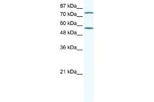 WB Suggested Anti-IRF4 Antibody Titration:  5ug/ml  Positive Control:  Jurkat cell lysate (IRF4 anticorps  (N-Term))