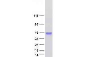 Validation with Western Blot