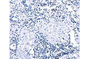 Immunohistochemistry (IHC) image for anti-DNA (Cytosine-5-)-Methyltransferase 3 alpha (DNMT3A) antibody (ABIN1872325) (DNMT3A anticorps)