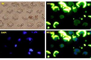 HCC36 cells were stained with SNAI1-FITC labeled monoclonal antibody (Green).