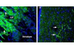 Expression of SynGAP in mouse globus pallidus and rat lateral septum - Immunohistochemical staining of perfusion-fixed frozen mouse and rat brain sections using Anti-SynGAP Antibody (ABIN7043789, ABIN7045176 and ABIN7045177), (1:200), followed by goat-anti-rabbit-AlexaFluor-488.